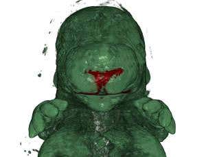 Your face may have been sculpted by junk DNA