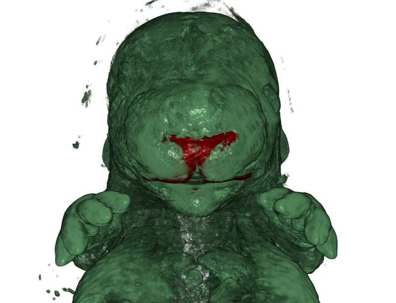 New Scientist. Science news and long reads from expert journalists, covering developments in science, technology, health and the environment on the website and the magazine.