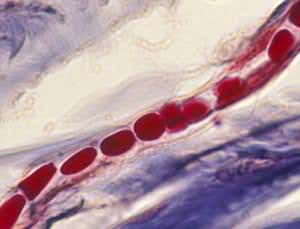 Warm your blood to track dangerous oozes