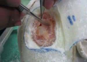 3D-printed skull simulates sensations of brain surgery