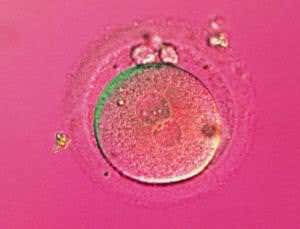 Genetic test screens embryo without disturbing it