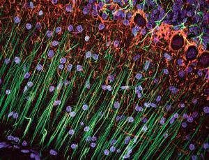 Grow a new brain: First steps to lab-made grey matter