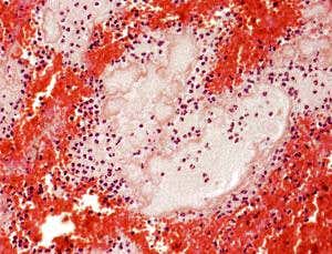 Plastic injection protects mouse hearts after attack