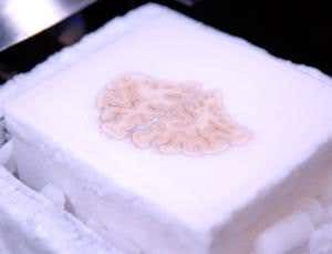 Neuroscience's most famous brain is reconstructed