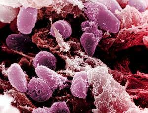 Black Death may have scuppered Roman Empire