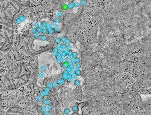 First glimpse of how HIV swamps the gut's immune cells