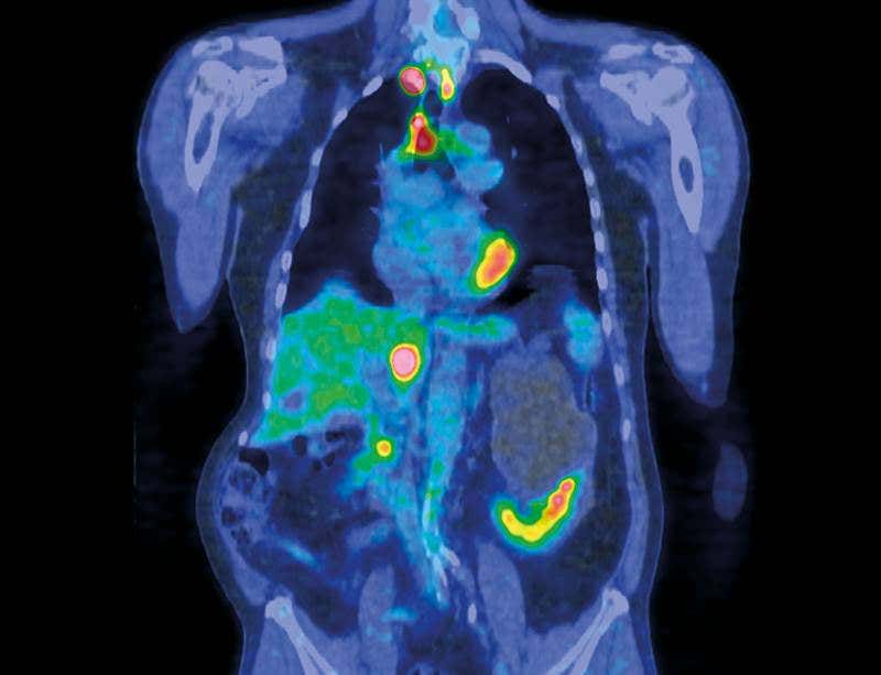 New Scientist. Science news and long reads from expert journalists, covering developments in science, technology, health and the environment on the website and the magazine.