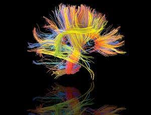 Brain zapping makes role of mirror neurons clearer