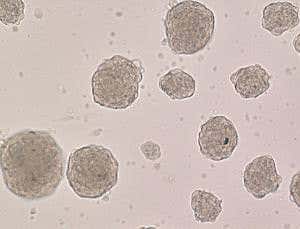 Extraordinary stem cell method tested in human tissue