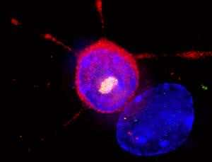 New cache of fresh neurons found in human brains