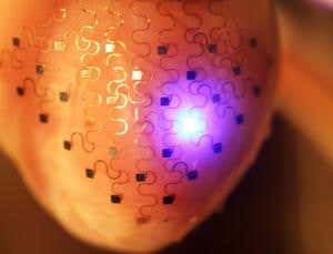 Electric heart sock could kick out pacemakers