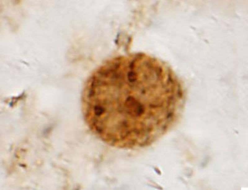 Lava fossilised this Jurassic fern down to its cells