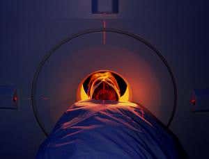 Scans can be vital in judging severity of brain damage