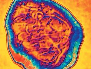 Will an antiviral drug put paid to measles?