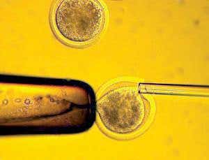Insulin-making cells created by Dolly-cloning method