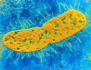 Antibiotic-resistant superbugs now a global epidemic