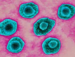 Catching cancer: The riveting quest for a killer virus