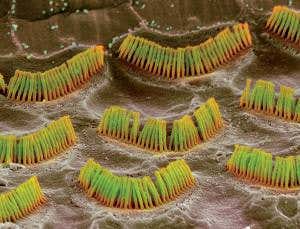 Deaf people get gene tweak to restore natural hearing