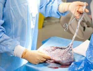 Baby's first gut bacteria may come from mum's mouth