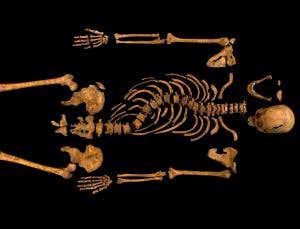 Teen growth spurt left Richard III with crooked spine