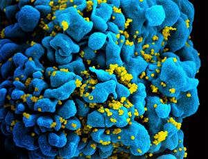 Gene editing tool can write HIV out of the picture