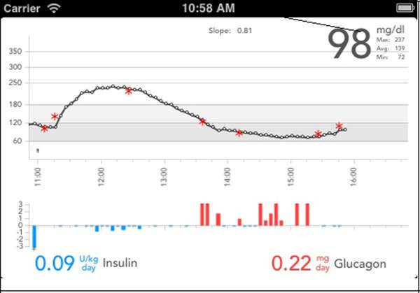 The smartphone component of the bionic pancreas system displays in an upper panel the blood sugar levels (black circles) that are reported by the glucose monitor every 5 minutes, supplemented by any fingerstick readings (red asterisks) taken by the user. The lower panel shows doses of insulin (blue) or glucagon (red) automatically administered in response to blood sugar variations 