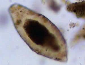 Stone Age worm egg hints at origins of modern scourge