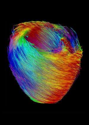 Rainbow 'bird's nest' MRI reveals how a heart beats