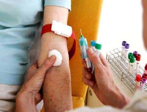Simple blood test gives early warning of Alzheimer's