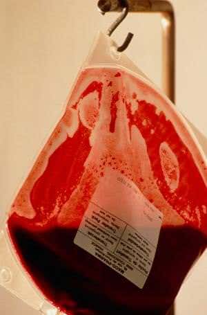 Latest HIV 'cure' claims prompt calls for more caution