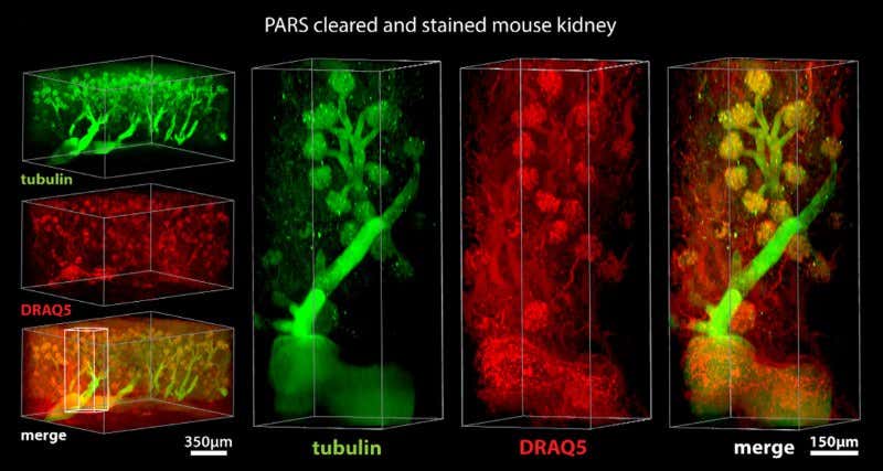Detergent treatment turns a mouse see-through
