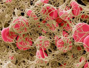 Targeted clot-busting drug won't boost bleeding risk