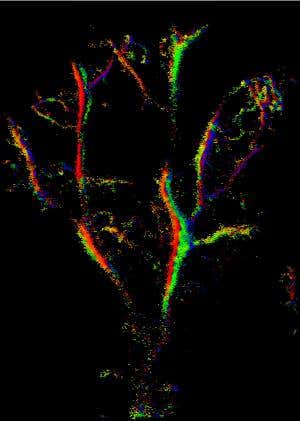 Microbubbles illuminate a rainbow web of blood vessels