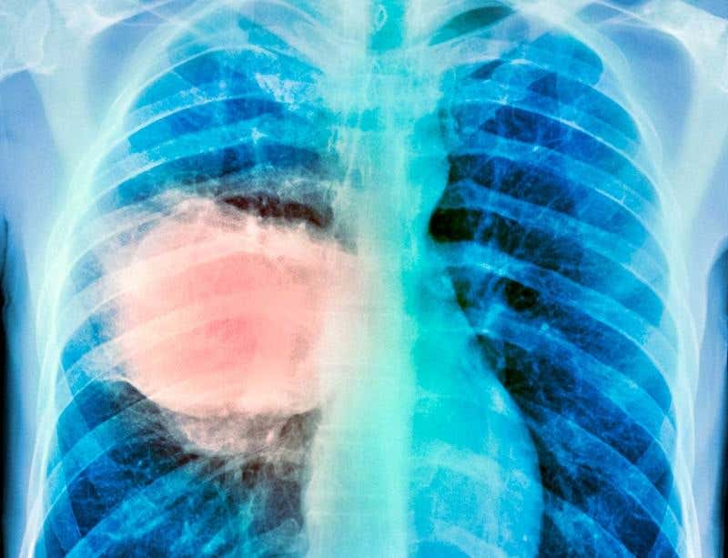 New Scientist. Science news and long reads from expert journalists, covering developments in science, technology, health and the environment on the website and the magazine.