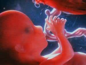 Fetus's arthritis genes can affect the mother