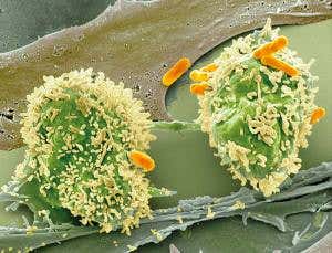 Enlist our microbiomes in the fight against cancer