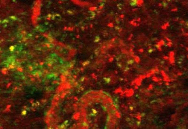 New Scientist. Science news and long reads from expert journalists, covering developments in science, technology, health and the environment on the website and the magazine.