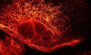 Us vs universe: Seeing smaller than the limit of light