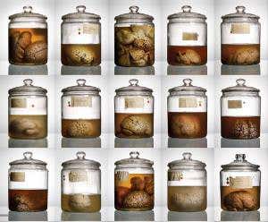 Bizarre brains highlight missing organ mystery