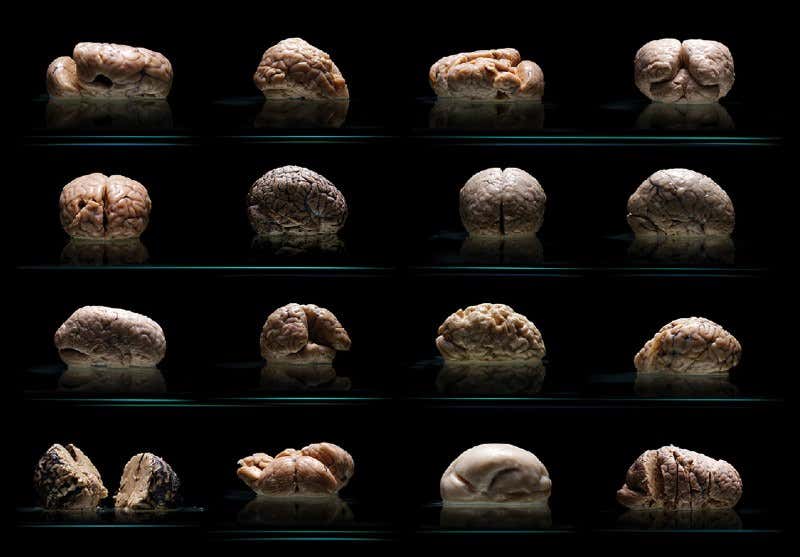 Bizarre brains highlight missing organ mystery