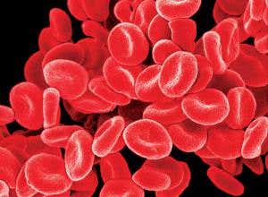 Cereal killer: Are you eating too much iron?