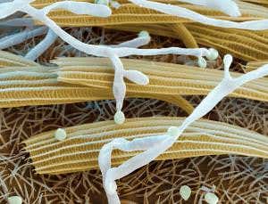 Fungal fighters: Cruel weapons of the forest floor