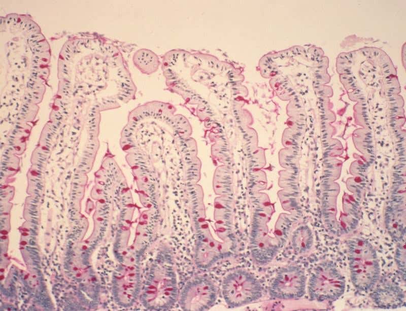 New Scientist. Science news and long reads from expert journalists, covering developments in science, technology, health and the environment on the website and the magazine.