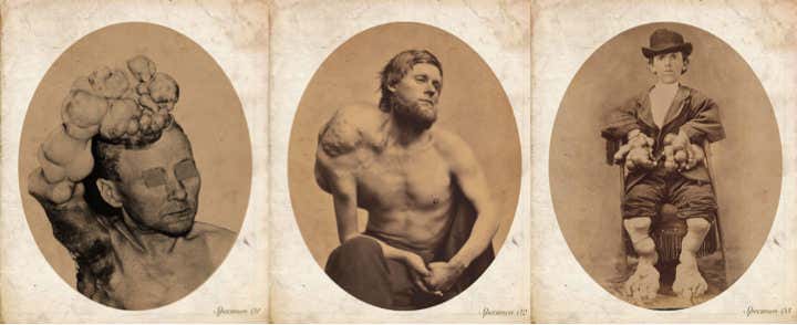 Cancer-warped skeletons imagined for building design