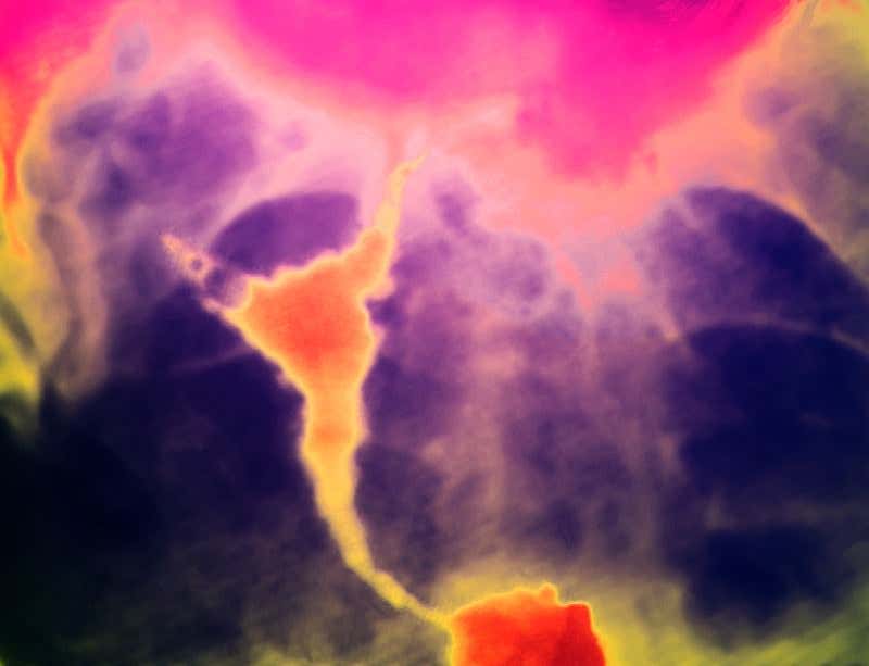 New Scientist. Science news and long reads from expert journalists, covering developments in science, technology, health and the environment on the website and the magazine.