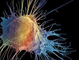 New one-in-two cancer figure sounds scarier than it is