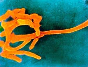 Common gum-disease bug may also give cancer a boost