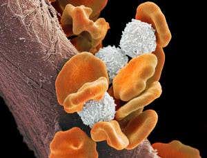 Mutation order reveals what cancer will do next