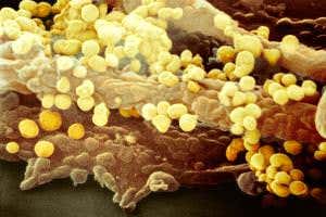 French toddler nearly killed by flu had gene mutation