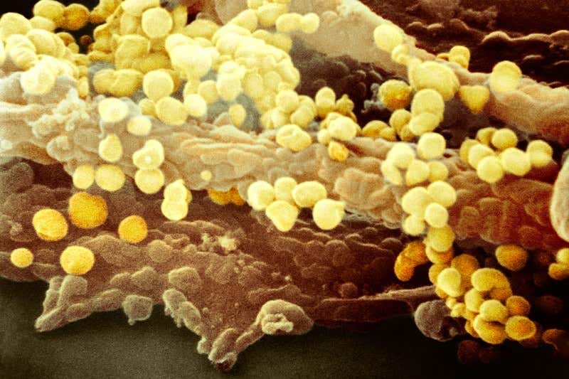 New Scientist. Science news and long reads from expert journalists, covering developments in science, technology, health and the environment on the website and the magazine.